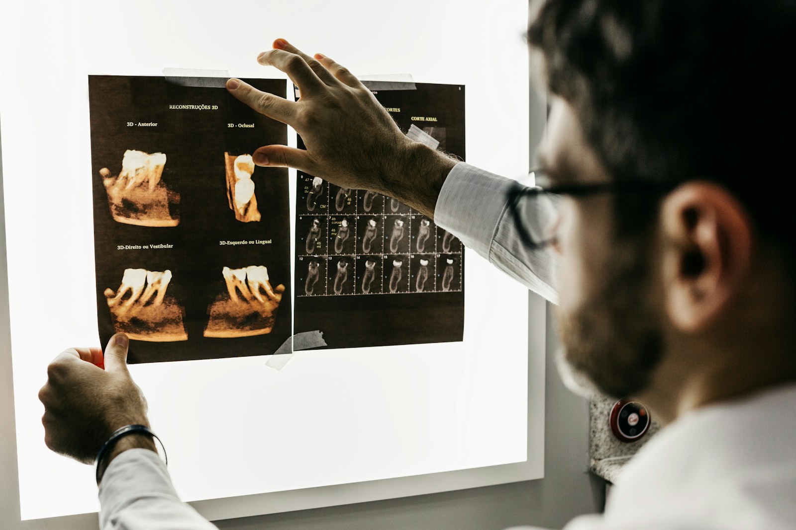 Professional bekijkt gedetailleerde dentale scans